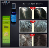 LANTHOME Hair Growth Spray